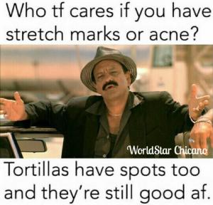 Who tf cares if you have stretch marks or acne?

Tortillas have spots too and they're still good af.