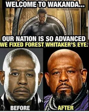 Welcome to Wakanda...

Our nation is so advanced we fixed Forest Whitaker's eye.

Before

After