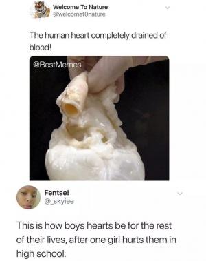 The human heart completely drained of blood!

This is how boys hearts be for the rest of their lives, after one girl hurts them in high school.